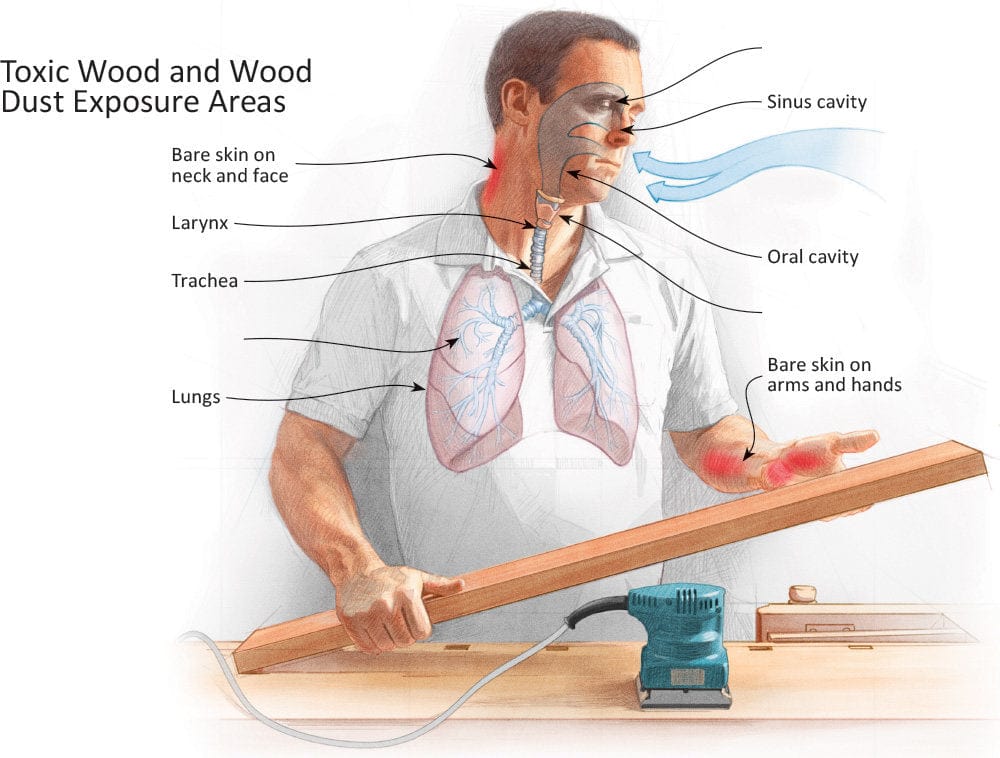 Infographic of the effects of toxic wood exposure on different parts of the body
